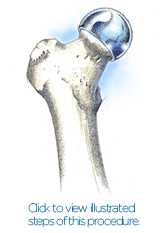 Jeffrey McLaughlin, MD